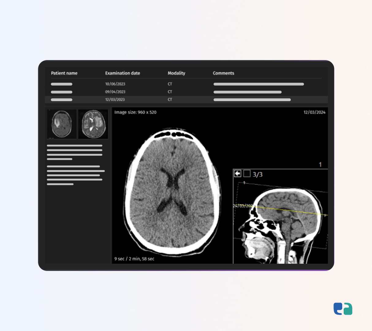 3D-Rendering-for-X-rays--CT-scans